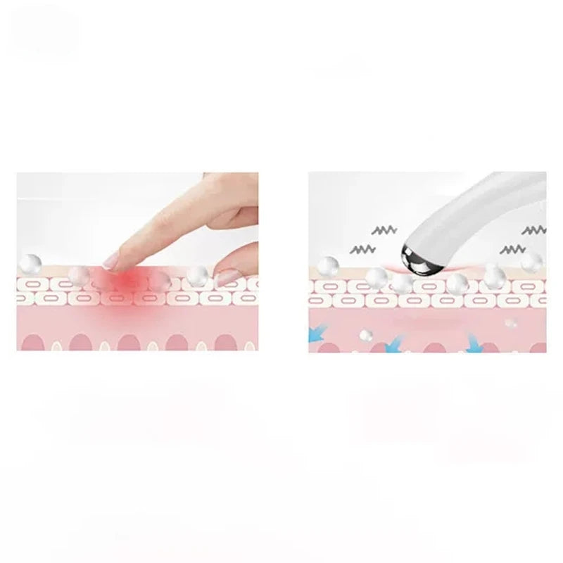 BESTUL Eyes Wrinkle Removing Pen Eye Massage Instrument Vibration Beauty Pen
